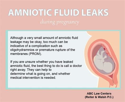 amniotic.fluid leaking|Leaking amniotic fluid (premature rupture of membranes)